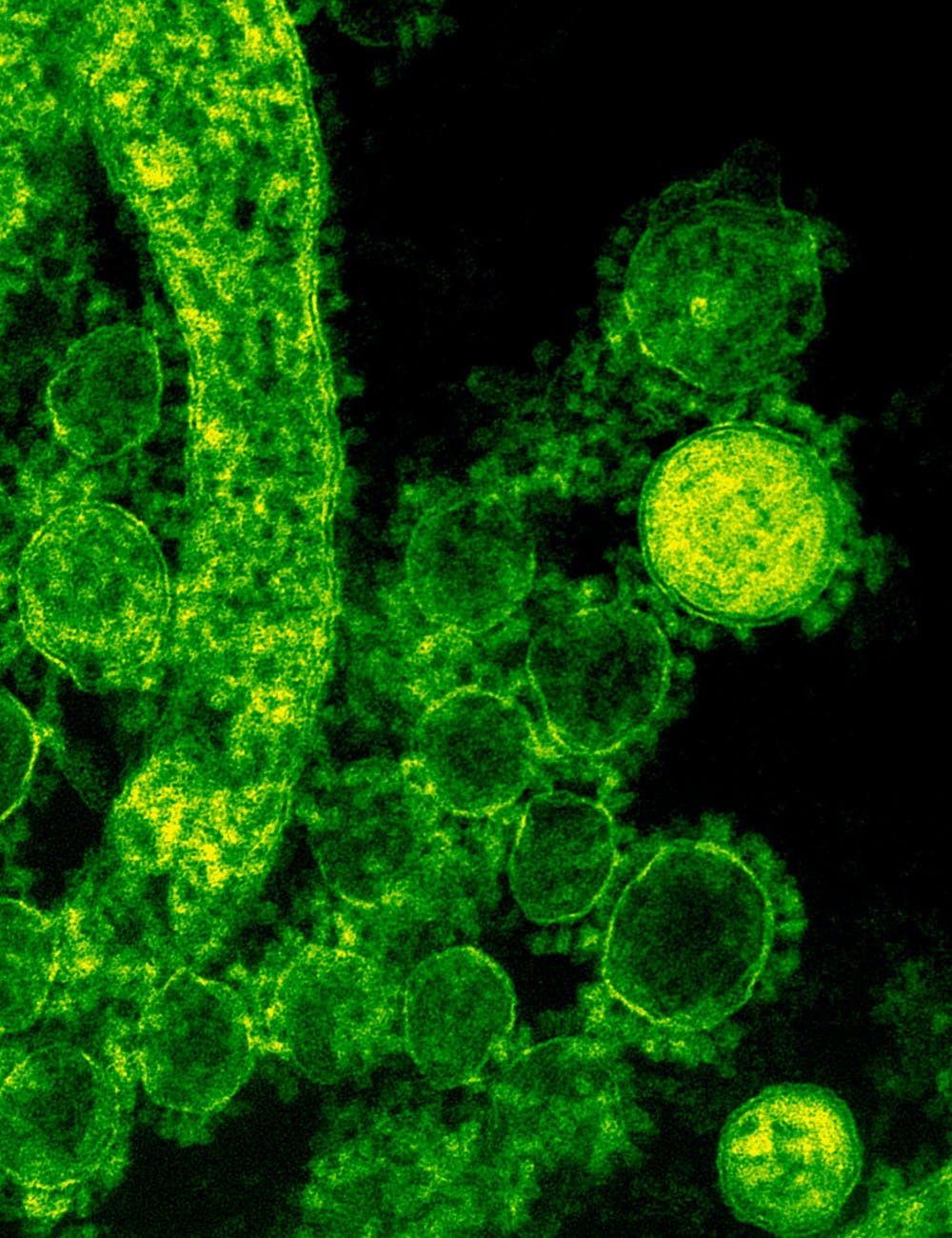 CRISPR/Cas – Bacteria’s impressive immunity system